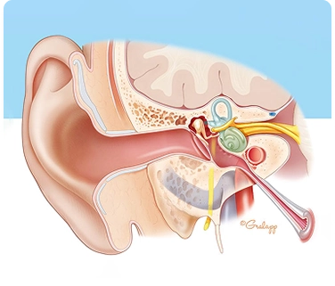 Ear Surgery Illustrated